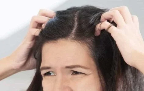 علت خارش پوست سر زنان