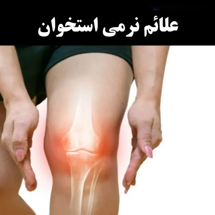 نرمی استخوان در بزرگسالان چیست و چگونه درمان می شود؟