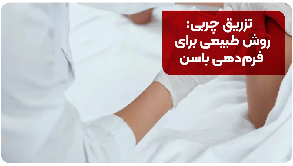 تزریق چربی: روش طبیعی برای فرم&zwnj;دهی باسن